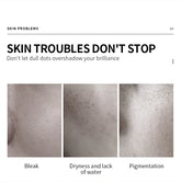 VEZE Moisturizing for the face, pore reduction, freckles, and smooth - 100ml